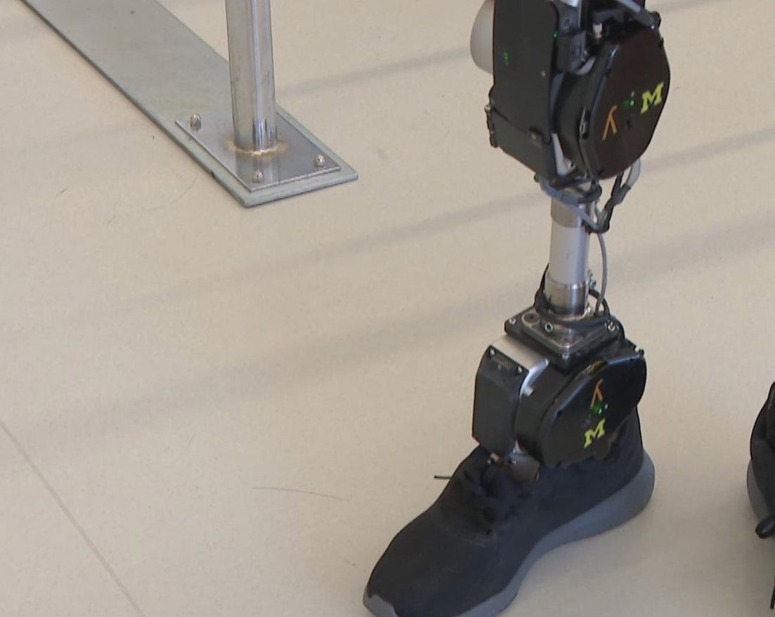 rimworld implants and bionics